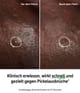 Produktbild 2 von 4, The INKEY List Hydrocolloid Invisible Pimple Patches