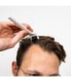 Scandinavian Biolabs Scalp Activation Dermaroller 1 Stk 5745000007615 visual2-shot_de