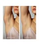 FOREO PEACH™ 2 IPL-Gerät 1 Stk 7350120791436 visual2-shot_de