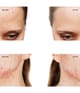 Produktbild 5 von 6, FOREO ESPADA™ 2 Gesichtspeeling
