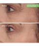 Produktbild 2 von 6, Murad Resurgence Augencreme