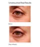 Produktbild 2 von 4, Murad Resurgence Augenserum