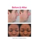 PMD Personal Microderm Pro Microdermabrasion 1 Stk 811485030211 visual-shot_de