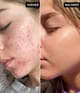 Produktbild 4 von 5, The INKEY List Niacinamide Serum Gesichtsserum