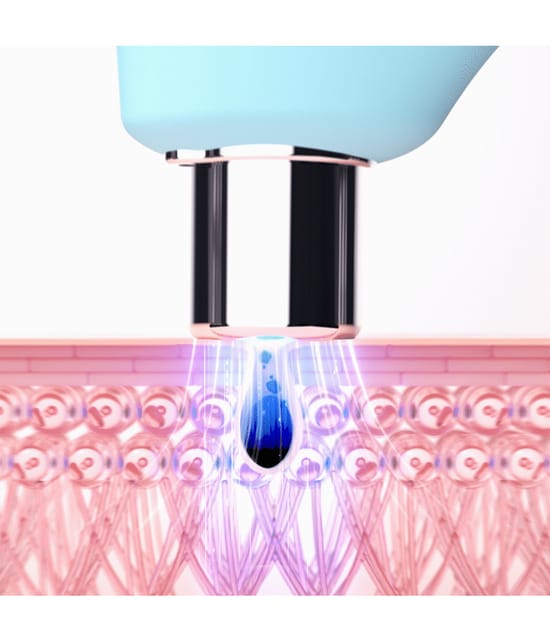 FOREO KIWI™ Lichttherapiegerät 1 Stk 7350120791948 visual-shot_de