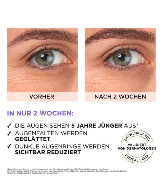 Produktbild 3 von 6, L'Oréal Paris Revitalift Augenserum