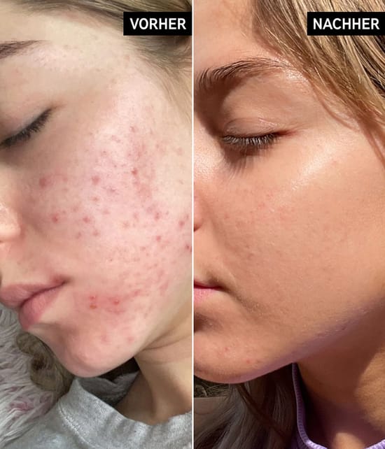 Produktbild 4 von 5, The INKEY List Niacinamide Serum Gesichtsserum