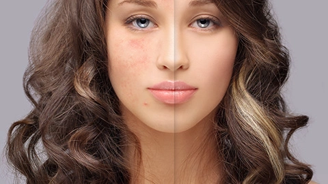 Frau mit roten Hautstellen versus Make-up