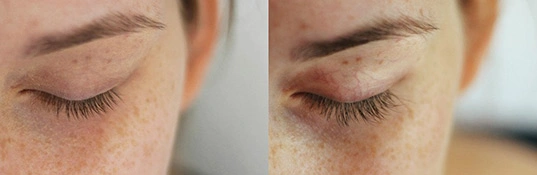 RevitaLash Wimpernserum Test von Bloggerin Vivian